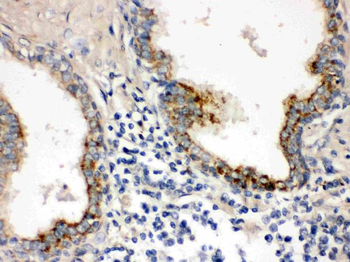 PTP4A2 Rabbit Polyclonal Antibody