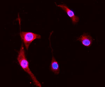 MRP8/S100A8 Antibody