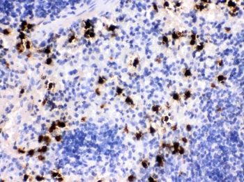 MRP8/S100A8 Antibody
