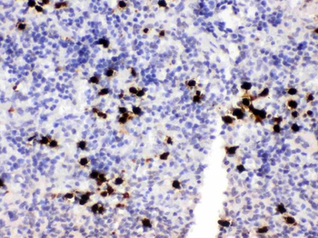 MRP8/S100A8 Antibody