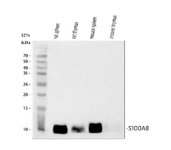 MRP8/S100A8 Antibody