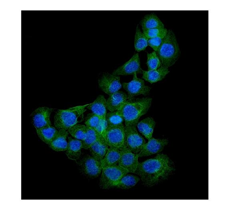 Syndecan-1/SDC1 Rabbit Polyclonal Antibody