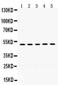 Syndecan-1/SDC1 Rabbit Polyclonal Antibody