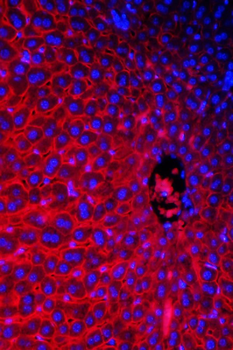 SLC10A1 Rabbit Polyclonal Antibody