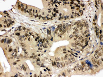 SMC3 Rabbit Polyclonal Antibody