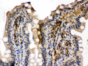 SMC3 Rabbit Polyclonal Antibody