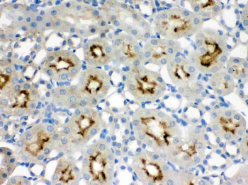 SMC3 Rabbit Polyclonal Antibody