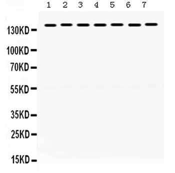 SMC3 Rabbit Polyclonal Antibody