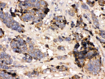 Prealbumin/TTR Rabbit Polyclonal Antibody