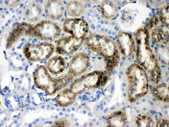 Prealbumin/TTR Rabbit Polyclonal Antibody