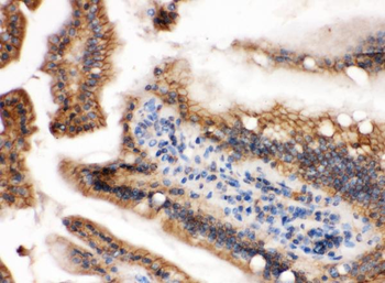GTPase HRAS Rabbit Polyclonal Antibody