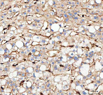 Actin/ACTA1 Rabbit Polyclonal Antibody