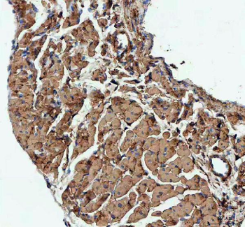 Actin/ACTA1 Rabbit Polyclonal Antibody