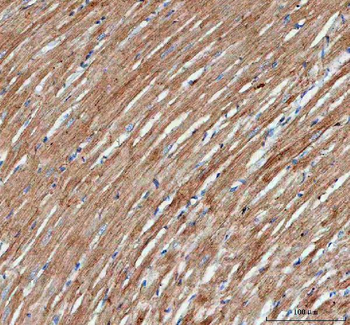 Actin/ACTA1 Rabbit Polyclonal Antibody