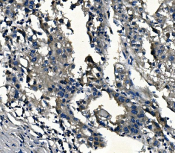alpha 1d Adrenergic Receptor/ADRA1A Rabbit Polyclonal Antibody
