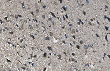 alpha 1d Adrenergic Receptor/ADRA1A Rabbit Polyclonal Antibody