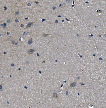 alpha 1d Adrenergic Receptor/ADRA1A Rabbit Polyclonal Antibody