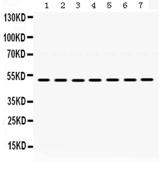 alpha 1d Adrenergic Receptor/ADRA1A Rabbit Polyclonal Antibody