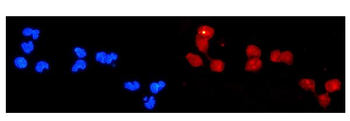 DDB2 Rabbit Polyclonal Antibody
