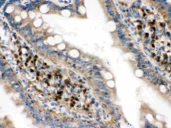 eIF4A2 Rabbit Polyclonal Antibody