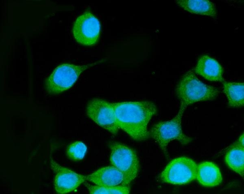 MEK3/MAP2K3 Rabbit Polyclonal Antibody