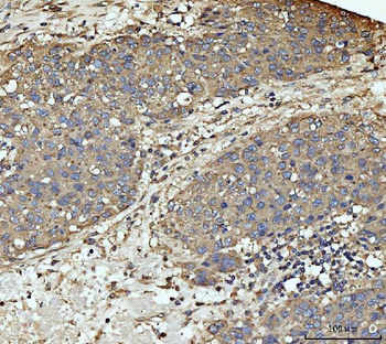 MEK3/MAP2K3 Rabbit Polyclonal Antibody