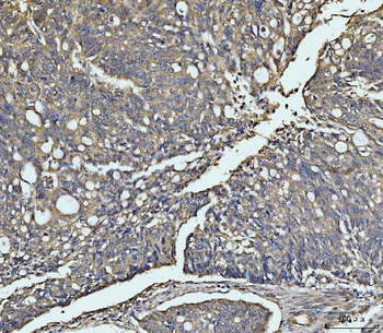 MEK3/MAP2K3 Rabbit Polyclonal Antibody