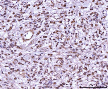 MEK7/MAP2K7 Rabbit Polyclonal Antibody