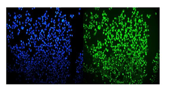 OGT/O-Linked N-Acetylglucosamine Transferase Antibody