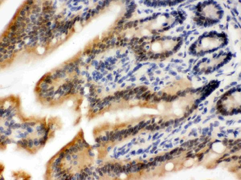 OGT/O-Linked N-Acetylglucosamine Transferase Antibody