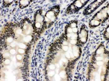 OGT/O-Linked N-Acetylglucosamine Transferase Antibody