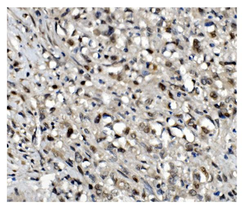 OGT/O-Linked N-Acetylglucosamine Transferase Antibody