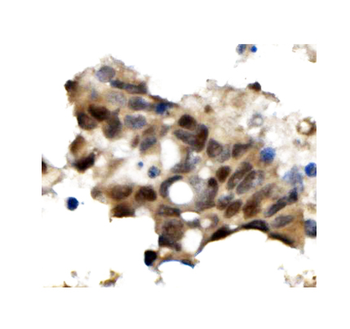 OGT/O-Linked N-Acetylglucosamine Transferase Antibody