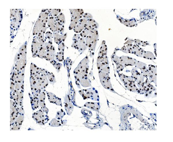 OGT/O-Linked N-Acetylglucosamine Transferase Antibody