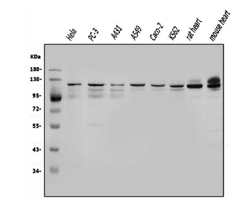 OGT/O-Linked N-Acetylglucosamine Transferase Antibody