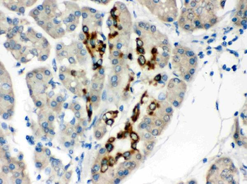 PAX6 Rabbit Polyclonal Antibody