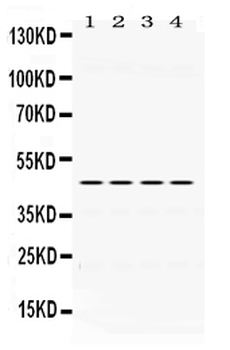 PAX6 Rabbit Polyclonal Antibody