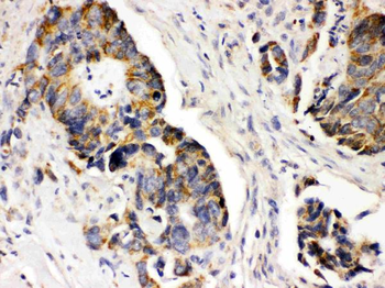 PDGF Receptor alpha/PDGFRA Rabbit Polyclonal Antibody