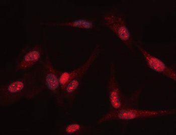 PGK1 Rabbit Polyclonal Antibody