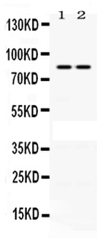 Phospholipase A2/PLA2G4A Rabbit Polyclonal Antibody