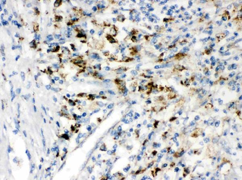 PPT1 Rabbit Polyclonal Antibody