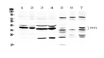 PPT1 Rabbit Polyclonal Antibody