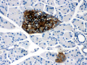 Prion protein PrP/PRNP Rabbit Polyclonal Antibody