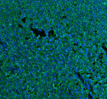CD45/PTPRC Rabbit Polyclonal Antibody