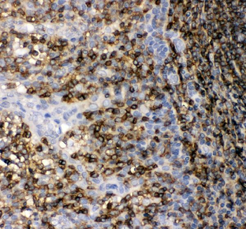 CD45/PTPRC Rabbit Polyclonal Antibody