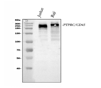 CD45/PTPRC Rabbit Polyclonal Antibody