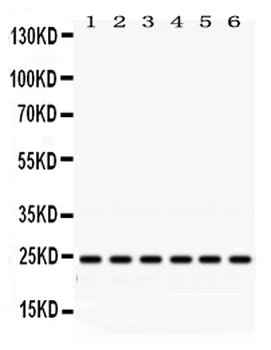 Rab5/RAB5A Rabbit Polyclonal Antibody