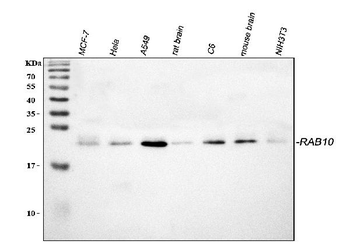 RAB10 Rabbit Polyclonal Antibody