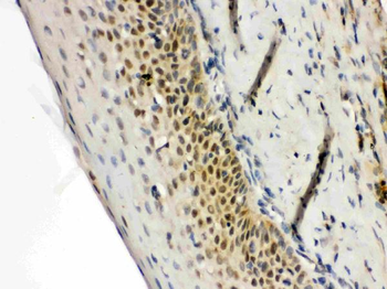 RAG2 Rabbit Polyclonal Antibody