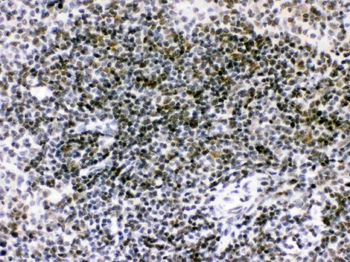 RAG2 Rabbit Polyclonal Antibody